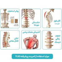 کمربند و قوزبند طبی درمانی حرفه ای ضد عرق TLSO|آرایشی، بهداشتی، درمانی|تهران, هفت چنار|دیوار