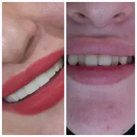 کامپوزیت دندان|خدمات آرایشگری و زیبایی|یاسوج, |دیوار