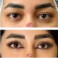 جراحی زیبایی سرپایی