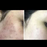 بینظیر|آرایشی، بهداشتی، درمانی|خرم‌آباد, |دیوار