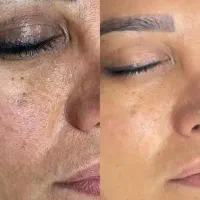 پوستت نیاز به یه بازسازی حرفه ای دار.