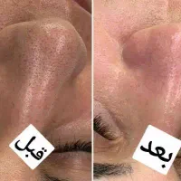 تخفیف فیشیال و پاکسازی و اموزش