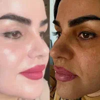 کرم vip روشن کننده پوست معجزه