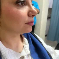 کلینیک تخصصی بوتاکس، ژل، فیلر،طب سوزنی،لاغری|خدمات زیبایی و سلامت|تبریز, |دیوار