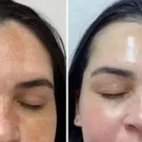 پاک کننده قوی لکه    ص و ر ت     و       ب د ن