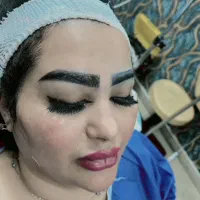 کاشت مو ابرو بلفاروپلاستی مزو تراپی پی آرپی|خدمات آرایشگری و زیبایی|تهران, صادقیه|دیوار