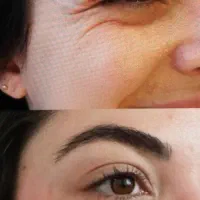 ژل فیلر بوتاکس انزیم|خدمات آرایشگری و زیبایی|خرم‌آباد, |دیوار