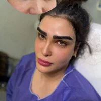 کاشت مو و کاشت ابرو وتزریق ژل و بوتاکس و مزو|خدمات آرایشگری و زیبایی|بهبهان, |دیوار