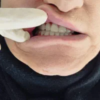 دندانسازی|خدمات آرایشگری و زیبایی|شیراز, امام حسین|دیوار