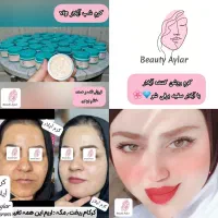 پوستت کدر و تیره شده نگران نباش با آیلار میدرخشی