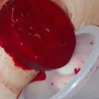 حجامت وزالو درمانی|خدمات آرایشگری و زیبایی|شیراز, مسلم|دیوار