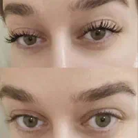 مشاوره رایگان پوست ومو