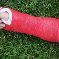 گچ گیری شکستگی ها تزریقات وپانسمان در منزل