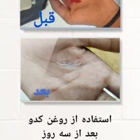 روغن خوراکی|خوردنی و آشامیدنی|برهسر, |دیوار