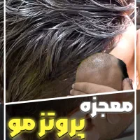پروتز مو فروش و تعمیرات تخصصی