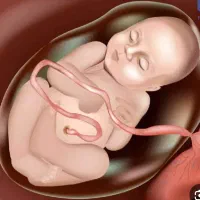 اهداتخمک رحم جایگزین