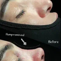 عمل بینی|خدمات آرایشگری و زیبایی|کرج, عظیمیه|دیوار