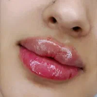 خدمات ژل فقط ۵۸۰ وبوتاکس ۷۵۰ در مطب|خدمات آرایشگری و زیبایی|نجف‌آباد, حومه نجف آباد|دیوار