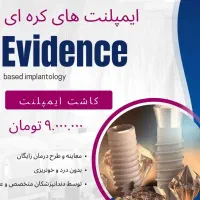 ایمپلنت کره ای