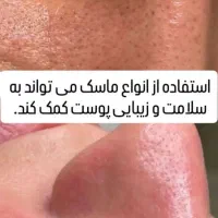 فشیال بانوان Vip+نیاز به مدل فقط هزینه مواد