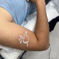 پاک کردن تتو با تکنولوژی روز،بی خطر ومقرون به صرفه|خدمات آرایشگری و زیبایی|دزفول, |دیوار