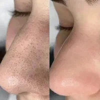 فشیال‌تخصصی۷۰۰،کربوکسی،پلاژن،اسید،پارافین‌تراپی