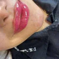 لک صورت بوتاکس خال موی سر ریش|خدمات آرایشگری و زیبایی|اهواز, کیان اباد|دیوار