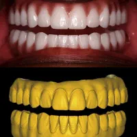 طراحی و آموزش برنامه اگزوکد دندانسازی