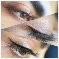 مرکز خط چشم دائم و بن مژه نوبهار