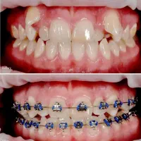دندانپزشکی و ارتودنسی با حداقل پیش پرداخت