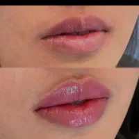 آف ژل و بوتاکس ،کاشت مژه و اصلاح صورت