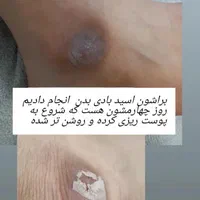 جشنواره پاکسازی و فیشیال پوست|خدمات آرایشگری و زیبایی|اصفهان, جلفا|دیوار