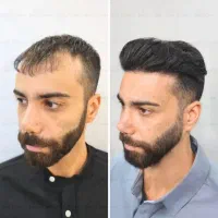 تفاوت بین داشتن مو و لذت بردن از مو را تجربه کنید
