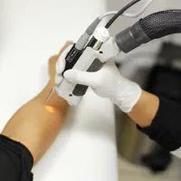 استخدام اپراتور لیزر