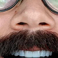 کامپوزیت دندان فکی ۸تومن|خدمات آرایشگری و زیبایی|تهران, والفجر|دیوار