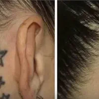 حذف انواع تاتو و خالکوبی با کیوسوئیچ|خدمات آرایشگری و زیبایی|برازجان, |دیوار