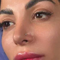مدل فیلر لب|خدمات آرایشگری و زیبایی|تهران, قیطریه|دیوار