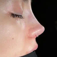 عمل جراحی زیبایی بینی لیفت صورت جراحی گوش اندام