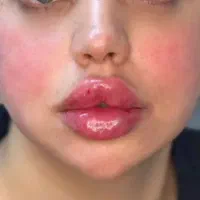 آف ژل وبوتاکس|خدمات آرایشگری و زیبایی|مسجد سلیمان, |دیوار