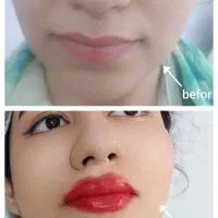 زیبایی و جوانی باجوان سازی طبیعی/اگزوزوم/ژل/بوتاکس|خدمات آرایشگری و زیبایی|تهران, صادقیه|دیوار