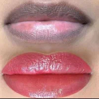 لک صورت بوتاکس خال موی سر ریش|خدمات آرایشگری و زیبایی|اهواز, کیان اباد|دیوار