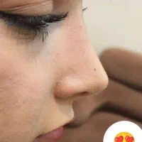 عمل جراحی بینی، ترمیمی،  لیفت صورت،  لیپو ابدو|خدمات آرایشگری و زیبایی|تهران, نارمک|دیوار