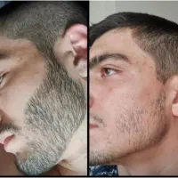 تضمین ریشاد با خودم