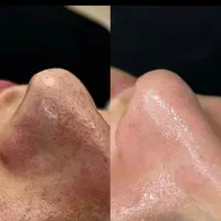 فیشیال پوست/پاکسازی پوست/کوتاهی مو/کراتینه