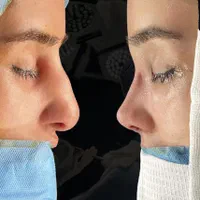 جراحی بینی ابدوساکشن بلفارو(پلک)غبغب تیپ پلاستی|خدمات آرایشگری و زیبایی|مشهد, احمدآباد|دیوار