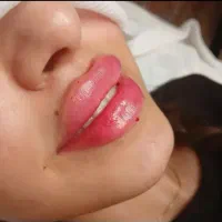 خدمات ژل .فیلر .فول بادی|خدمات آرایشگری و زیبایی|شیراز, پودنک|دیوار