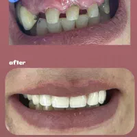 نیازمند شاگرد دندانسازی (ثابت)