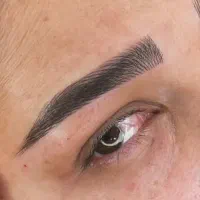 فیبروز. میکرو بلیندینگ