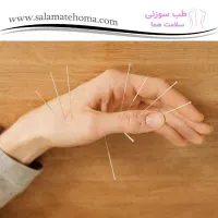 دوره تخصصی طب سوزنی با ارائه مدرک بین‌المللی|خدمات آموزشی|تهران, پیروزی|دیوار