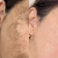 سفید شو دعام کن (بیوممتیک همه کاره) تخفیف روز دختر